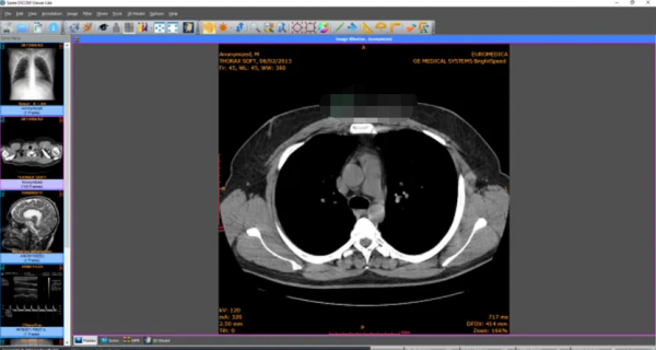 Sante PACS Server PG 4.4.2 医疗影像存储系统服务器软件